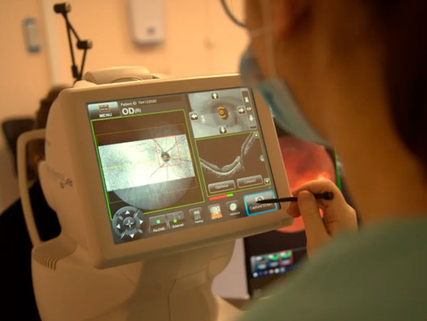 Московские офтальмологи получили новое оборудование для диагностики нарушений зрения
