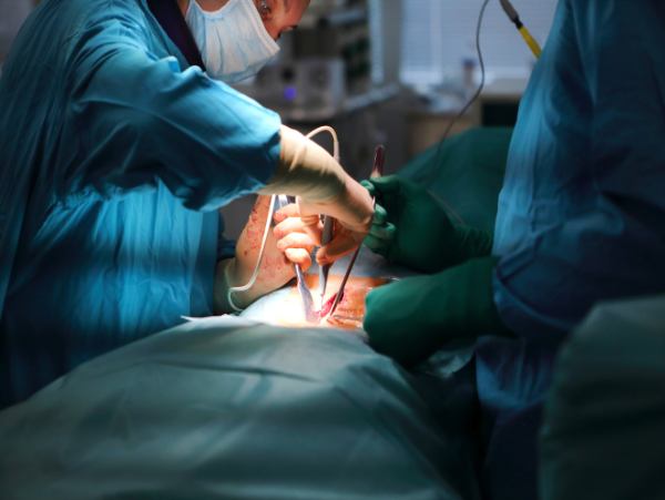 Многоэтапное лечение разрыва опухоли печени выполнили хирурги больницы Вересаева