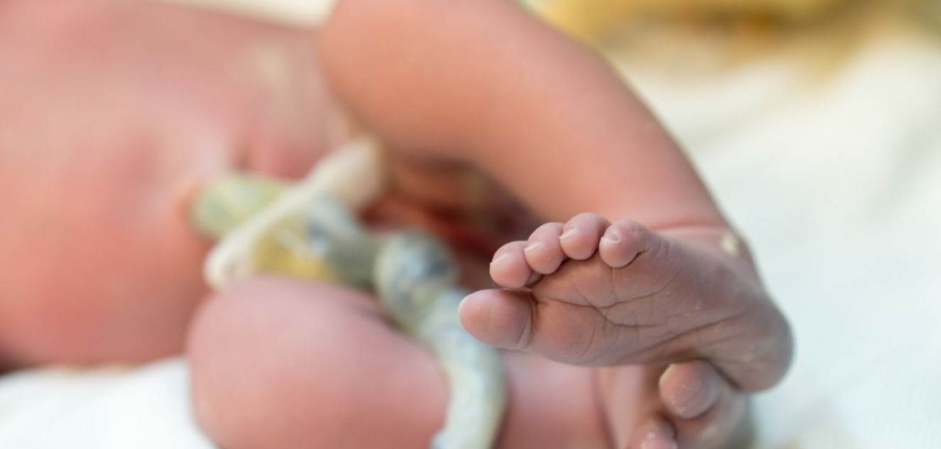 Московские врачи помогли родиться малышу с четырехкратным обвитием и тромбозом пуповины