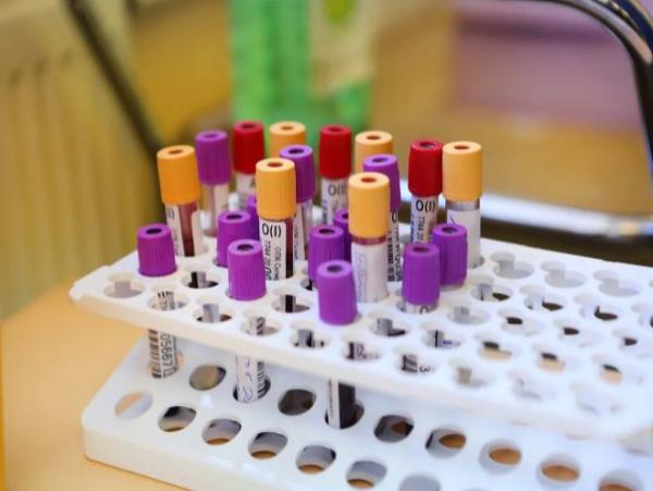 Лаборатория центра дерматовенерологии и косметологии провела более 1 миллиона тестов на коронавирус